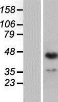 Western Blot: ING1 Overexpression Lysate [NBP2-04707]