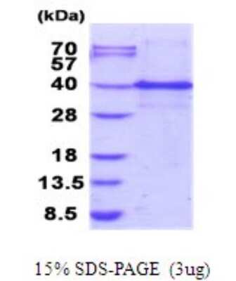 SDS-PAGE: Recombinant Human ING1 His Protein [NBP2-51900]