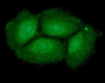 Immunocytochemistry/ Immunofluorescence: ING2 Antibody (AT39E5) - BSA Free [NBP2-61159]