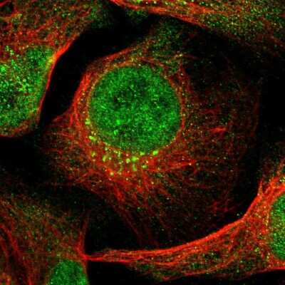 Immunocytochemistry/ Immunofluorescence: ING2 Antibody [NBP3-05515]