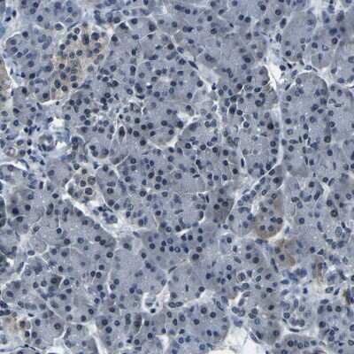 Immunohistochemistry-Paraffin: ING2 Antibody [NBP3-05514]