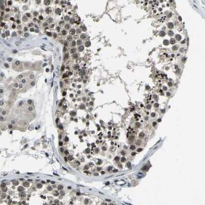 Immunohistochemistry-Paraffin: ING2 Antibody [NBP3-05514]
