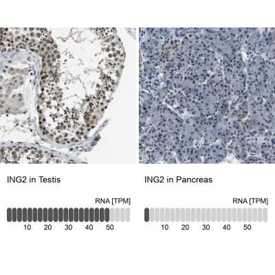 Immunohistochemistry-Paraffin: ING2 Antibody [NBP3-05514]
