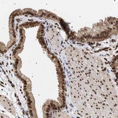 Immunohistochemistry-Paraffin: ING2 Antibody [NBP3-05515]