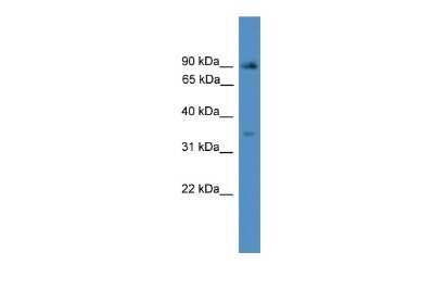 Western Blot: ING2 Antibody [NBP2-84090]