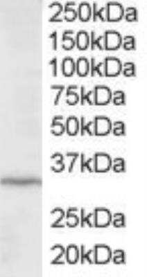 Western Blot: ING2 Antibody [NBP2-88866]