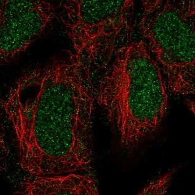 Immunocytochemistry/ Immunofluorescence: ING3 Antibody [NBP3-05525]