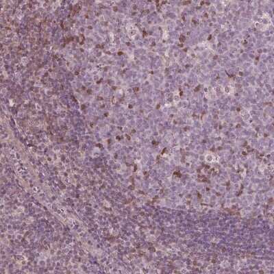 Immunohistochemistry-Paraffin: ING3 Antibody [NBP3-05524]