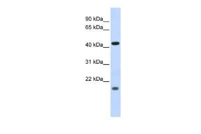 Western Blot: ING3 Antibody [NBP2-86986]