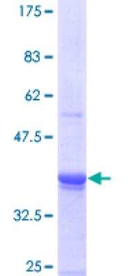 SDS-PAGE: Recombinant Human ING3 GST (N-Term) Protein [H00054556-P01]