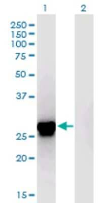 Western Blot: ING4 Antibody (8F7) [H00051147-M01]