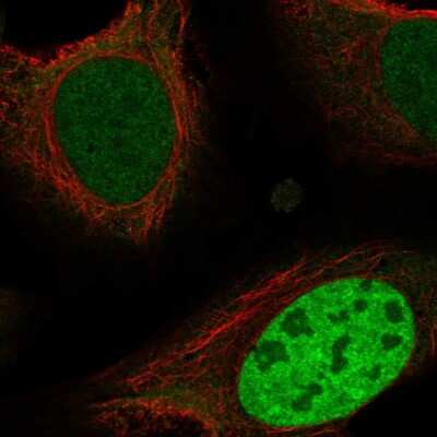 Immunocytochemistry/ Immunofluorescence: ING4 Antibody [NBP2-55457]