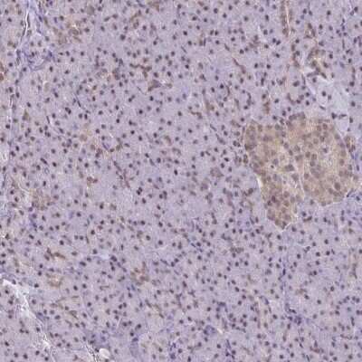 Immunohistochemistry-Paraffin: ING4 Antibody [NBP2-33828]