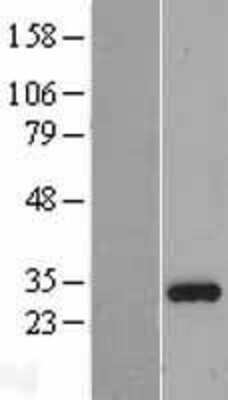 Western Blot: ING4 Overexpression Lysate [NBL1-11992]