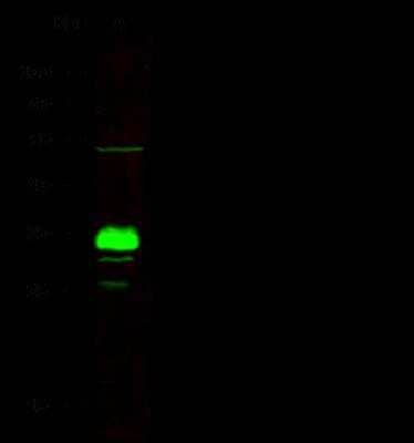 Western Blot: ING5 Antibody (119) [NBP2-90261]