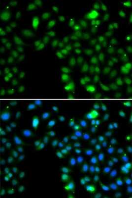 Immunocytochemistry/ Immunofluorescence: ING5 Antibody - BSA Free [NBP3-04538]
