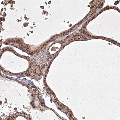 Immunohistochemistry-Paraffin: ING5 Antibody [NBP3-05519]