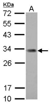 Western Blot: ING5 Antibody [NBP1-30999]