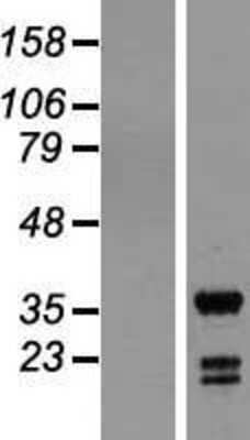 Western Blot: ING5 Overexpression Lysate [NBL1-11993]