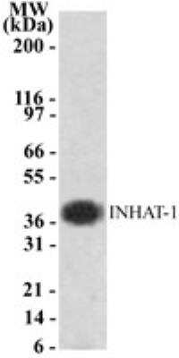 Western Blot: INHAT-1 Antibody [NB100-56353]