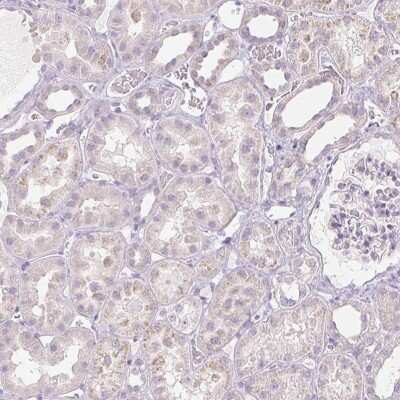 Immunohistochemistry-Paraffin: INHBE Antibody [NBP1-89262]