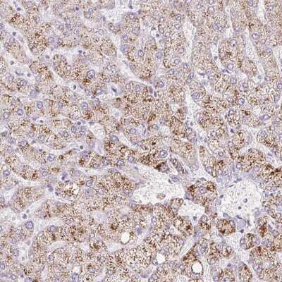 Immunohistochemistry-Paraffin: INHBE Antibody [NBP1-89262]