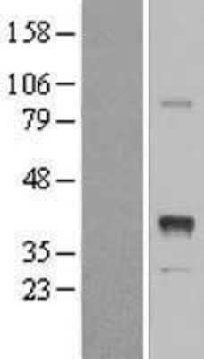 Western Blot: INHBE Overexpression Lysate [NBL1-11996]