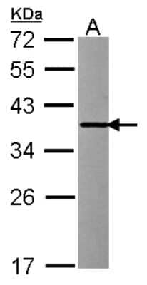 Western Blot: INMT Antibody [NBP2-16967]