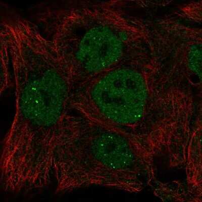 Immunocytochemistry/ Immunofluorescence: INO80 Antibody [NBP2-58955]