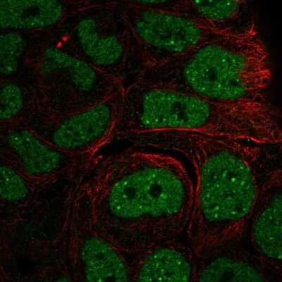 Immunocytochemistry/ Immunofluorescence: INO80 Antibody [NBP2-58963]