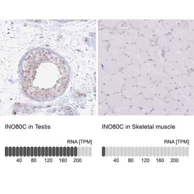 Immunohistochemistry-Paraffin: INO80C Antibody [NBP2-14123]