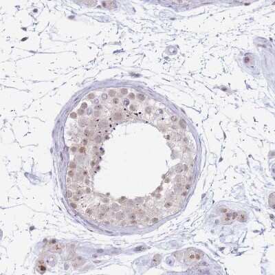 Immunohistochemistry-Paraffin: INO80C Antibody [NBP2-14123]