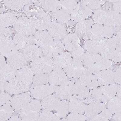 Immunohistochemistry-Paraffin: INO80C Antibody [NBP2-14123]