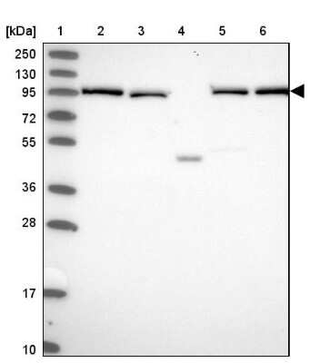 Western Blot: INO80D Antibody [NBP1-93981]