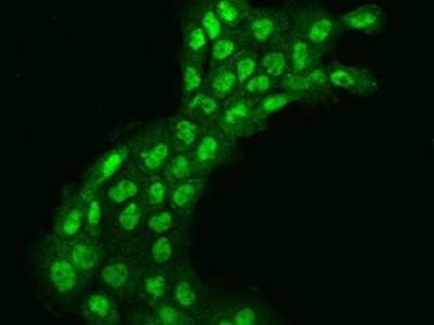 Immunocytochemistry/ Immunofluorescence: INO80E Antibody [NBP2-98592]