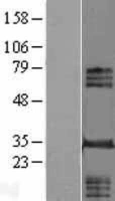 Western Blot: INO80E Overexpression Lysate [NBL1-08834]