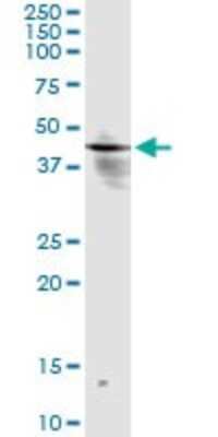 Immunoprecipitation: INPP1 Antibody (1A6) [H00003628-M14]