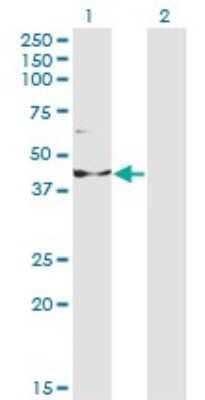 Western Blot: INPP1 Antibody (1A6) [H00003628-M14]