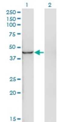 Western Blot: INPP1 Antibody (4F9) [H00003628-M11]