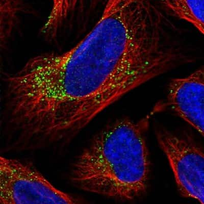 Immunocytochemistry/ Immunofluorescence: INPP1 Antibody [NBP2-48662]