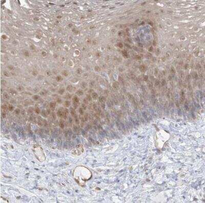 Immunohistochemistry-Paraffin: INPP1 Antibody [NBP1-85889]