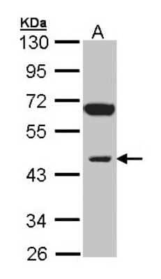 Western Blot: INPP1 Antibody [NBP1-31475]