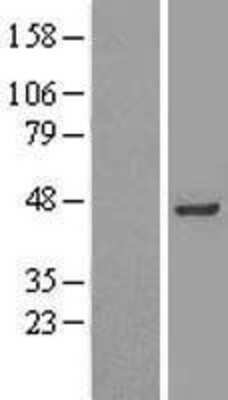 Western Blot: INPP1 Overexpression Lysate [NBP2-09490]