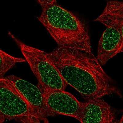 Immunocytochemistry/ Immunofluorescence: INPP4A Antibody [NBP1-92023]