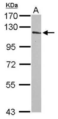 Western Blot: INPP4A Antibody [NBP2-16968]