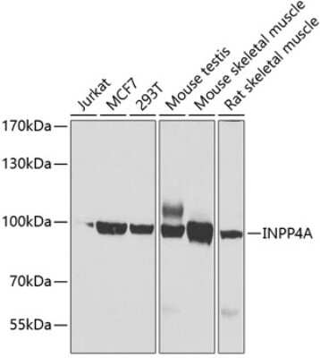 Western Blot: INPP4A AntibodyBSA Free [NBP3-04583]