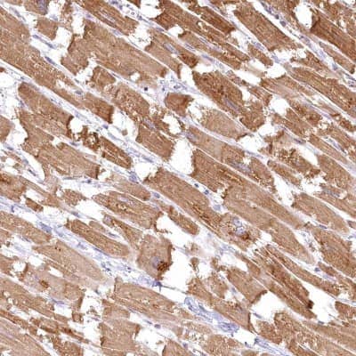 Immunohistochemistry-Paraffin: INPP4B Antibody [NBP1-85883]
