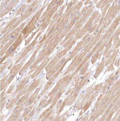 Immunohistochemistry-Paraffin: INPP4B Antibody [NBP1-86272]
