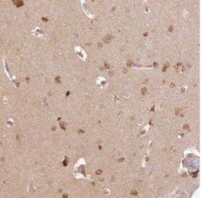 Immunohistochemistry-Paraffin: INPP4B Antibody [NBP1-86272]