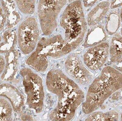 Immunohistochemistry-Paraffin: INPP4B Antibody [NBP1-86272]